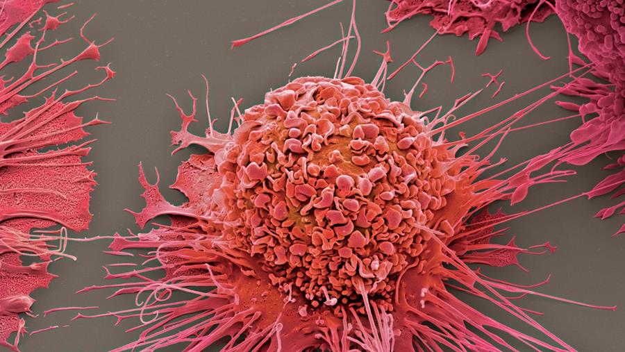 10 miljoen voor precisiebehandelingen tegen kanker en ontstekingsziekten